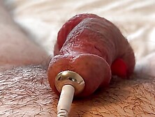 Prostate Electrojaculation Estim