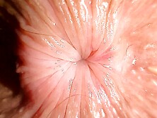 Extreme Close Up: Teenage Butthole Is Trying To Kiss You Trough The Screen Of Your Iphone