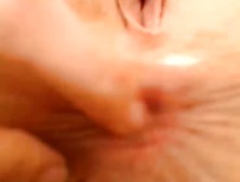 Asshole Upclose