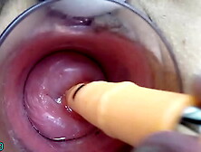 Oriental Milf Cervix Fucking with German real rod dildo and thai chopsticks