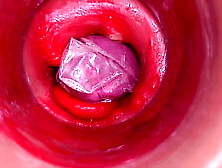 The camera inside the deep pussy records a huge ejaculation with a stuck condom